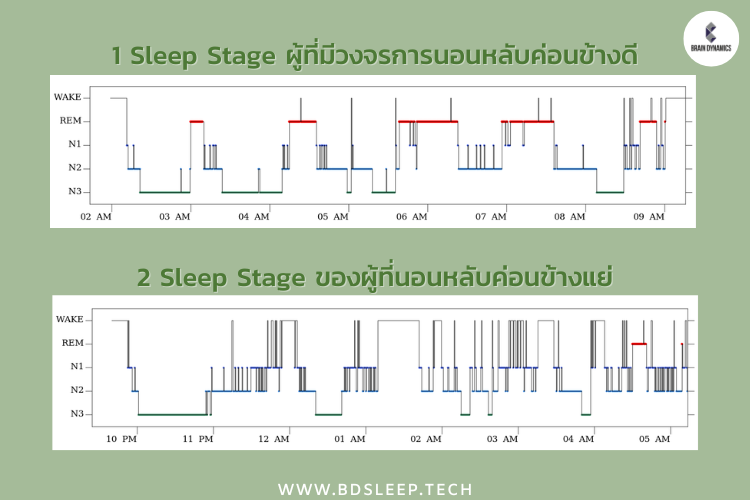 Sleep stage ระดับการนอนหลับ